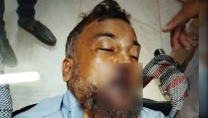 চাঁদার দাবিতে ঠিকাদারকে হাতুড়ি দিয়ে পিটিয়ে আহত  