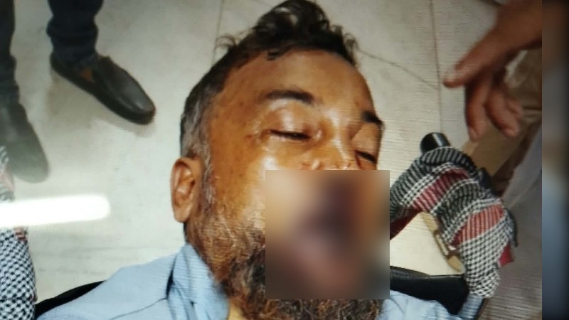 চাঁদার দাবিতে ঠিকাদারকে হাতুড়ি দিয়ে পিটিয়ে আহত  